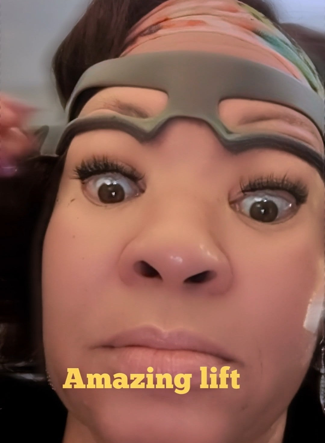 Lift & Lashes - Eyelid Lifter